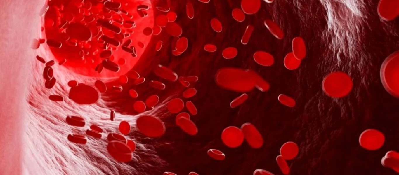 Ανεπάρκεια σιδήρου: Συμπτώματα, αίτια και θεραπεία